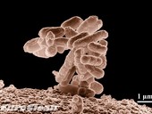 Vskyt koliformnch bakteri ve vod - mohou vznikat i rozkladem list ve studni, Escherichia coli, foto Euroclean